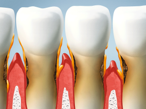 denti-gengive-osso-legamenti-parodonto-stefania-barbieri